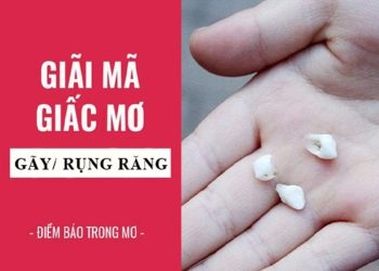 Mo-thay-gay-rang